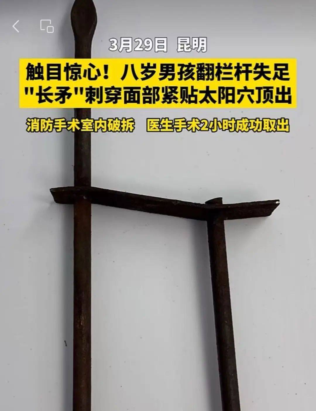 8岁男孩被“长矛”刺穿面部！家长吓坏了
